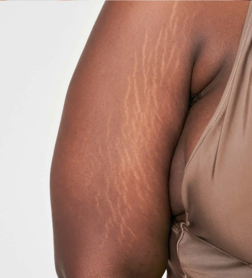 happy mature woman plus-size-woman-arm-s-white-stretch-mark-body-positivity-shoot